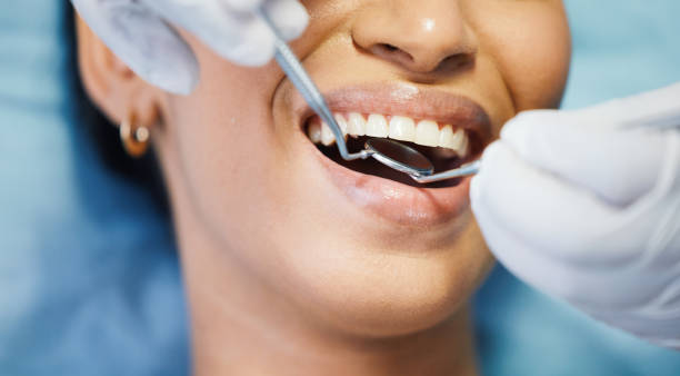 Best Emergency Dental Surgery in Litchfield, MI
